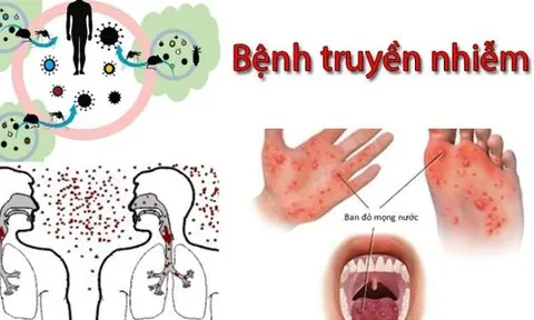 Nhiều bệnh truyền nhiễm đang có xu hướng gia tăng