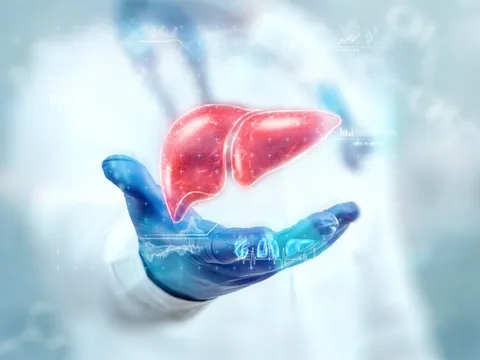 Fucoidan mang đến hi vọng cho người ung thư gan