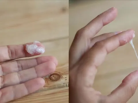 Mắc bệnh lậu sau khi 'trót dại' với nữ nhân viên massage