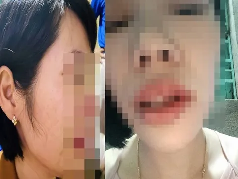 Điểm nhấn giáo dục: Thông tin mới nhất vụ phụ huynh đánh cô giáo vì con bị hạnh kiểm trung bình