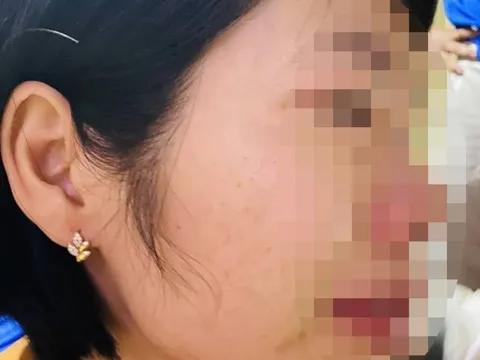 Tình tiết mới vụ phụ huynh đánh cô giáo vì con bị hạnh kiểm trung bình