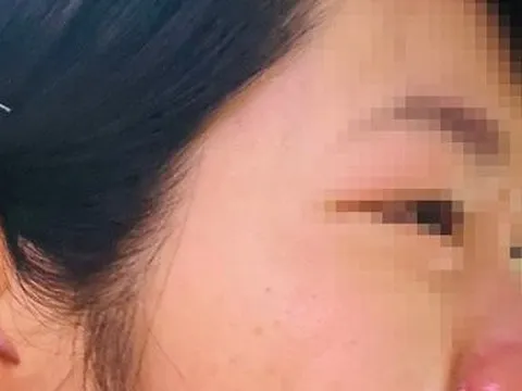 Xông đến nhà hành hung cô giáo, phụ huynh bị xử phạt 6,5 triệu đồng