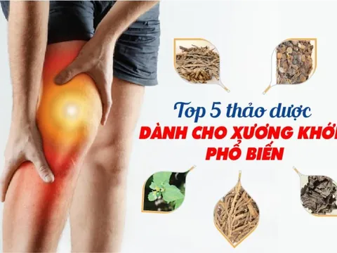 Top 5 thảo dược dành cho xương khớp phổ biến