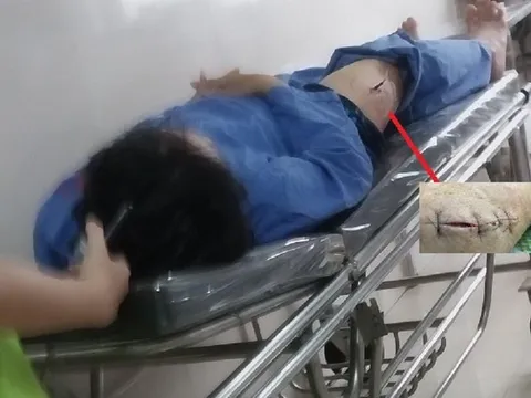 Cán bộ Cục Thuế Ninh Bình phản bác lời khai của kẻ dùng dao đâm mình