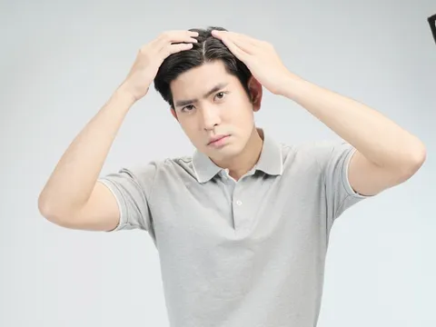 Giải pháp toàn diện nào cho tình trạng gàu ngứa dai dẳng trong mùa hè oi bức?