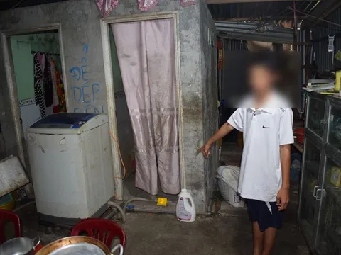 Tạm giữ hình sự gã cha dượng 9X đốt 'vùng kín' con riêng của vợ