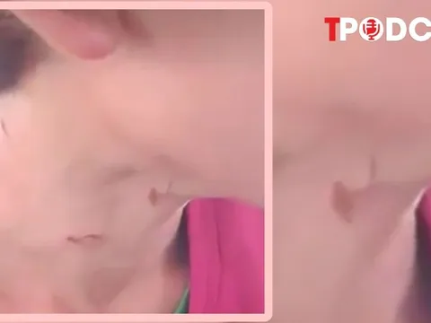 HÌNH SỰ: Điều tra vụ cha dượng 9x đốt 'vùng kín' con riêng của vợ