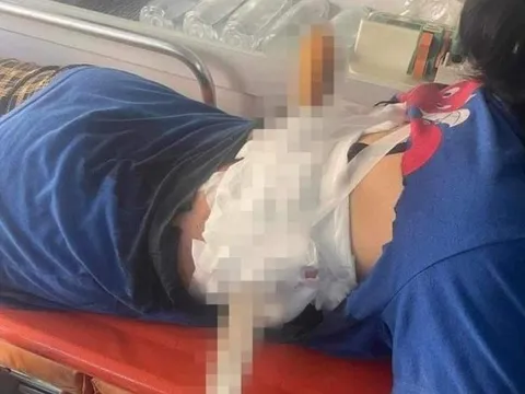 Chồng phóng dao xuyên lưng vợ