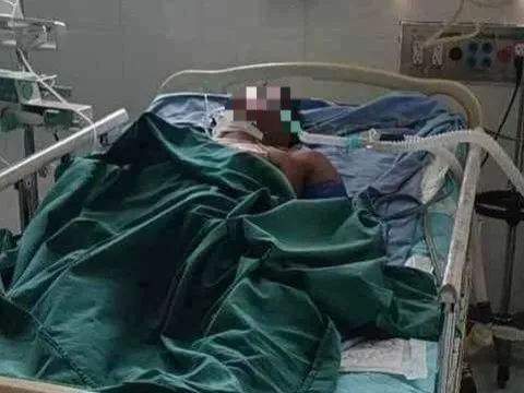 Người đàn ông nguy kịch vì ong vò vẽ đốt