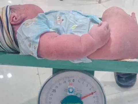 Sản phụ Nghệ An sinh thường con thứ 6 là bé trai nặng 5kg