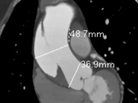 TPHCM: Người phụ nữ suýt tử vong, dấu hiệu cảnh báo chỉ đau ngực