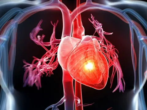 Những thực phẩm là ‘sát thủ’ với tim mạch, cần tránh xa tuyệt đối