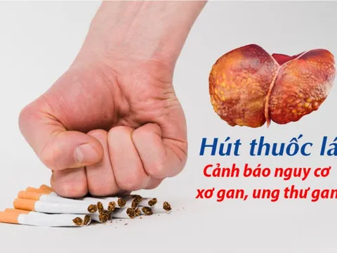 Hút thuốc lá – Mối nguy hiểm không chỉ phổi mà cả gan