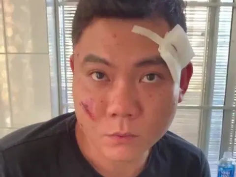 Khởi tố đối tượng nổ súng bắn bố và anh bạn gái ở Khánh Hòa