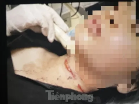 Cảnh sát thông tin vụ cô gái trẻ báo án bị cắt cổ, cướp tài sản ở Bình Dương