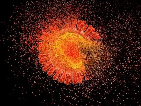 Các chuyên gia vạch ra lộ trình chấm dứt đại dịch AIDS vào năm 2030 như thế nào?