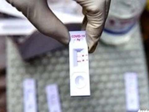 Có triệu chứng nghi ngờ mắc COVID-19, cần test nhanh không?