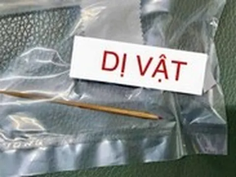 Lấy chiếc tăm nhọn dài 7cm nằm hơn 4 tháng trong bụng một bé trai
