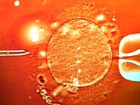 Người hiến tinh trùng mang gene ung thư, sinh ra ít nhất 67 trẻ, 10 em bị bệnh