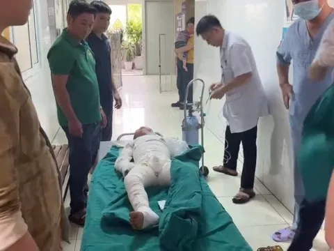 Sử dụng xăng để đốt diệt kiến, hai anh em bỏng nặng