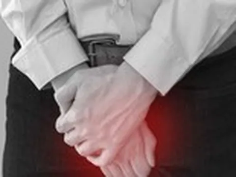 Có khối sùi nhỏ 10 năm không chữa, nay phát hiện ung thư dương vật