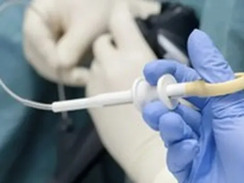 Viên thuốc thông minh thay thế nội soi đường tiêu hóa