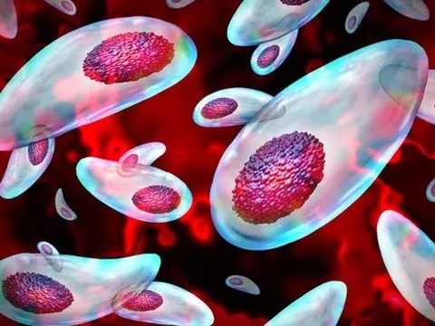 Một loại ký sinh có thể cắt đứt tinh trùng của con người, nguyên nhân gây vô sinh toàn cầu?