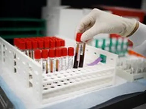 Phát hiện nhóm máu mới, cả thế giới chỉ một người có