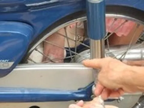 Bé gái 6 tuổi bị cuốn chân vào căm xe máy, gãy xương chày