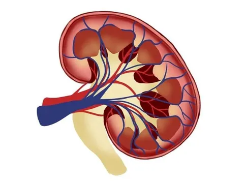 Có thể phát hiện các yếu tố di truyền trong bệnh thận mãn tính