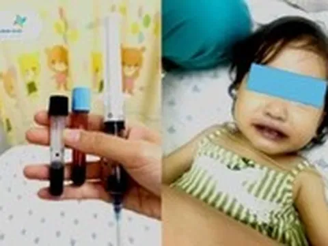 Máu của bé gái chuyển qua màu nâu sau khi ăn canh nấu bằng nước giếng