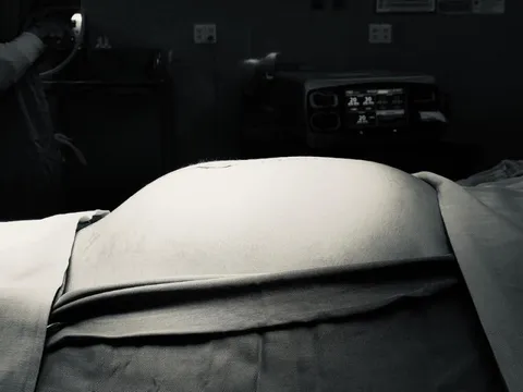 Bụng bé gái phình to nhanh chóng, bác sĩ mổ gấp để lấy khối u khổng lồ