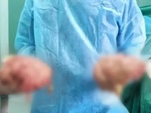 Nữ bệnh nhân mắc bệnh hiếm, hai vùng đùi bên ngoài như hai quả bóng