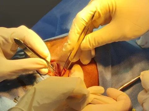 Cứu người đàn ông bị hàng xóm dùng đũa đâm xuyên hốc mắt