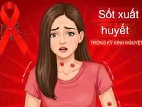 Cảnh giác sốt xuất huyết nhầm với chảy máu kinh nguyệt