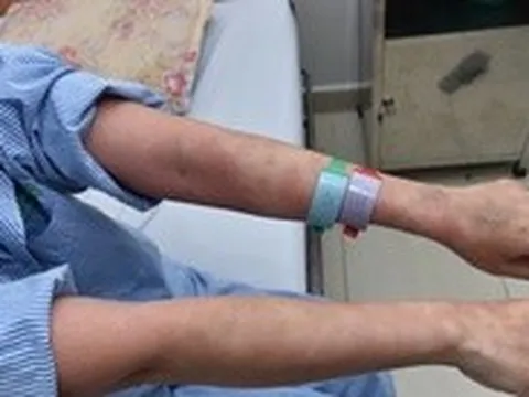 Nguy kịch sau khi dùng thuốc giảm mỡ bụng và collagen không rõ nguồn gốc