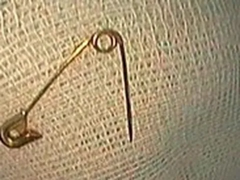 Hoảng hốt tìm cách lấy cây kim băng lại vô tình đẩy dị vật vào sâu trong họng trẻ
