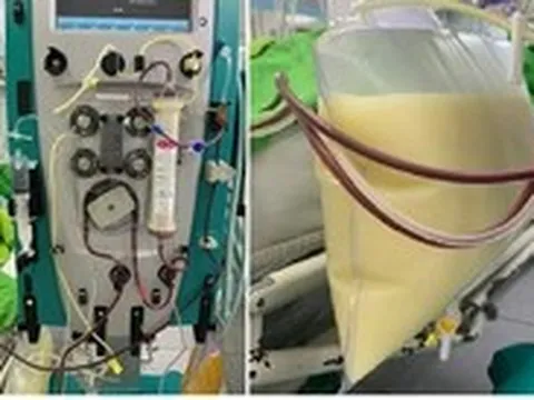 Mỡ máu cao gấp 37 lần dù gầy gò