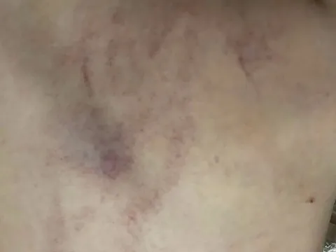 Nhanh chóng xác minh vụ việc nghi trẻ bị bạo hành tại Hà Nội