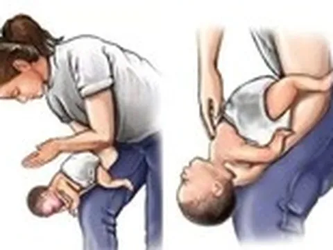 Bé 2 tuổi qua đời do hóc hạt nhãn