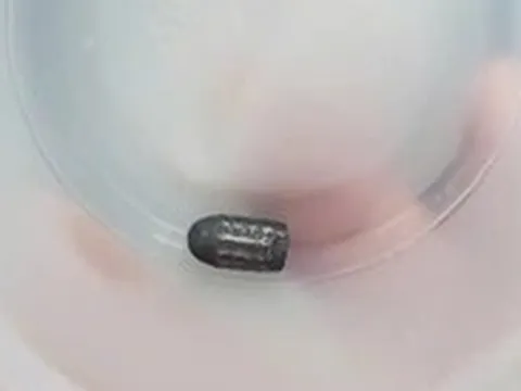 Đang làm vườn, người phụ nữ bất ngờ bị đạn bay trúng đầu