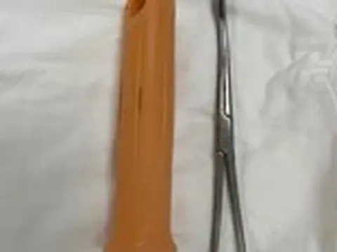 Thanh niên nhét cán cây lau nhà vào hậu môn, trôi sâu đến trực tràng