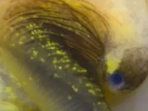 Phát hiện loài ốc mọc lại mắt, mở ra hy vọng tái tạo mắt cho người