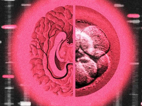 Chi 50.000 USD để ‘thiết kế’ con thông minh, giới siêu giàu Mỹ gây tranh cãi