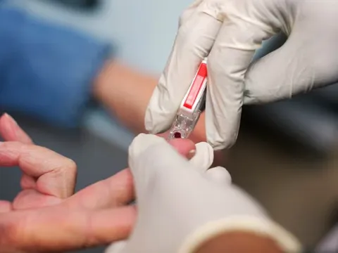 Xét nghiệm mới phát hiện bệnh nguy hiểm qua 1 giọt máu, giá chỉ 50.000 đồng