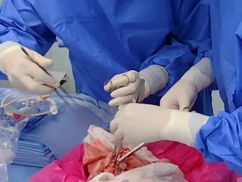 Lần đầu ghép thành công phổi heo cho người chết não