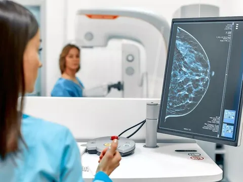 Có thật Thụy Sĩ cấm chụp nhũ ảnh vì lo ngại bức xạ và dương tính giả?