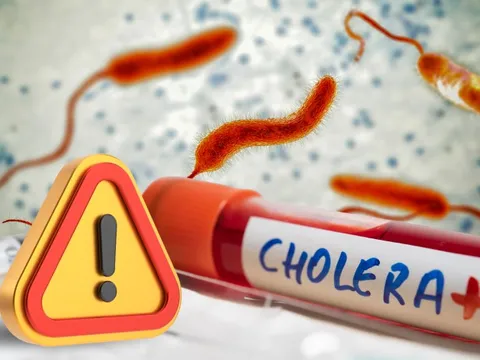 Dịch tả diễn biến phức tạp ở nhiều quốc gia, Bộ Y tế cảnh báo nguy cơ