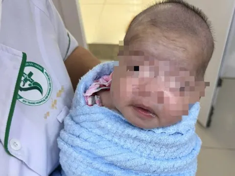 Trẻ sơ sinh 8 ngày tuổi bị uốn ván nặng