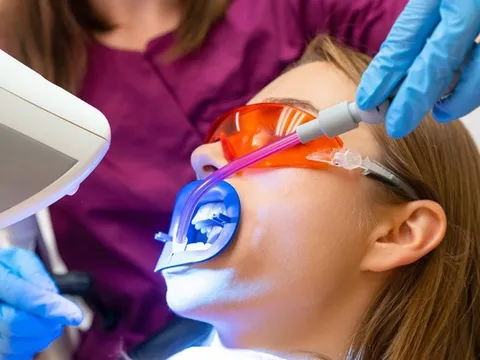 Những ngộ nhận phổ biến về làm trắng răng